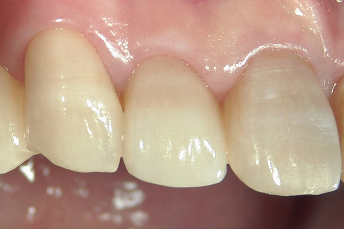 色のグラデーション