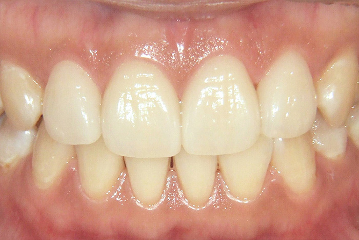 美しく理想的な歯ぐき