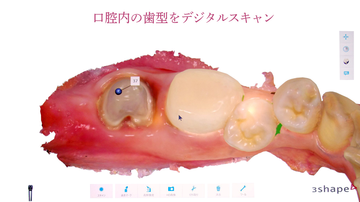 デジタルスキャン