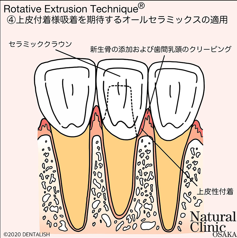 ヘミデスモゾーム結合