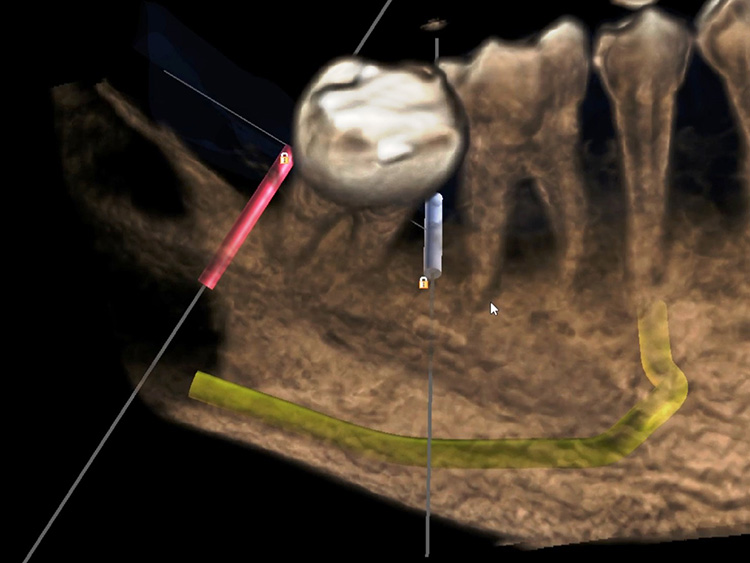 精密にコントロール