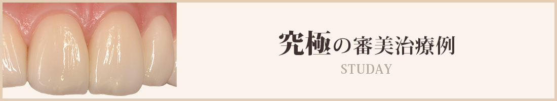 究極の審美治療例
