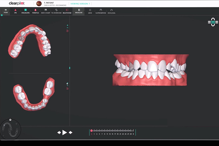 3D シミュレーション