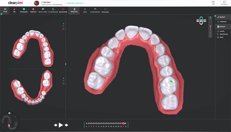 3D シミュレーション